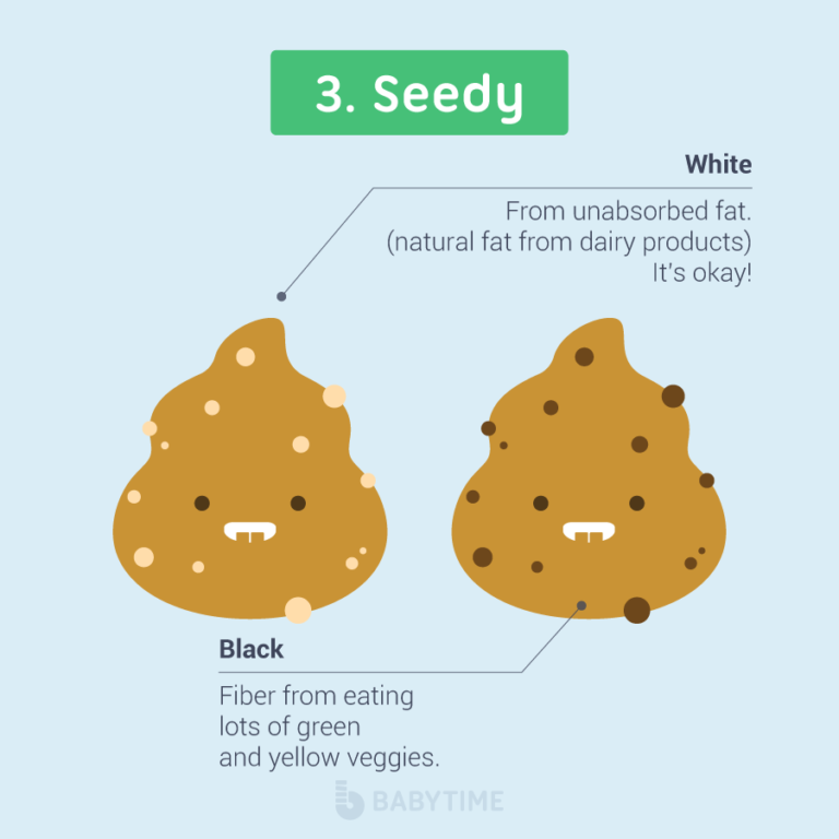 Why Is My Baby's Poop White